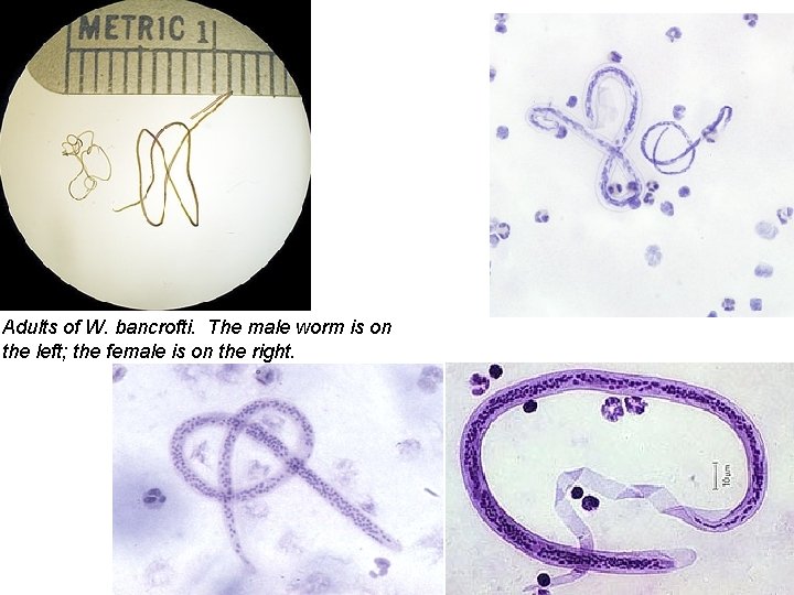 Adults of W. bancrofti. The male worm is on the left; the female is