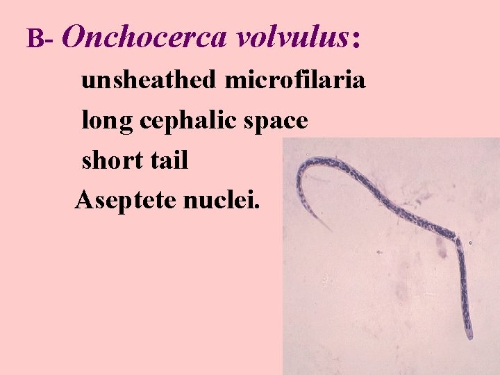 B- Onchocerca volvulus: unsheathed microfilaria long cephalic space short tail Aseptete nuclei. 
