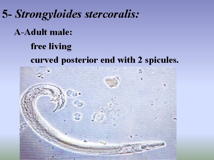 Lab 5 Strongyloides stercoralis Threadworm Trichinella spiralis The