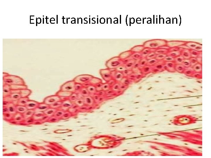 Epitel transisional (peralihan) 