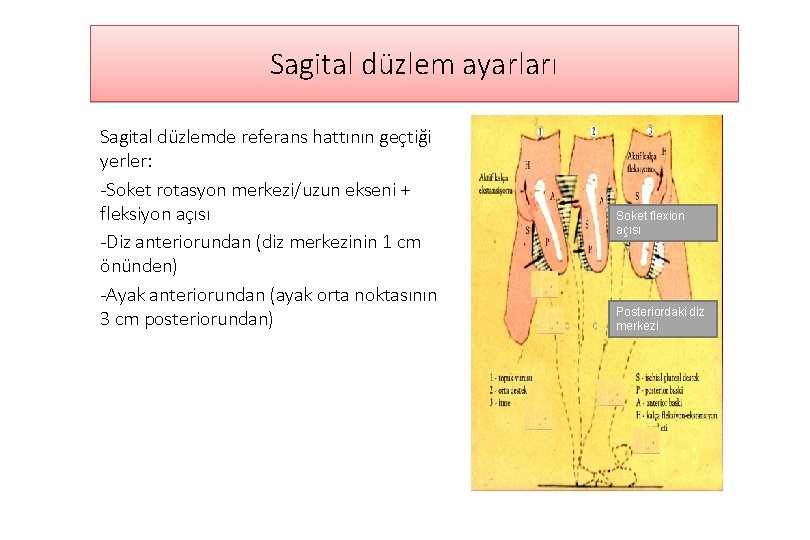 Sagital düzlem ayarları Sagital düzlemde referans hattının geçtiği yerler: -Soket rotasyon merkezi/uzun ekseni +