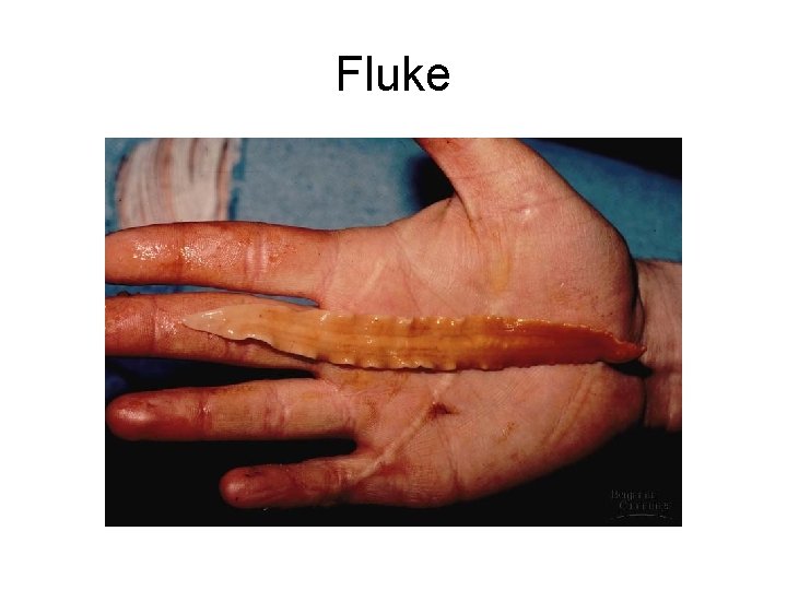 Fluke 