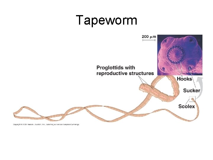 Tapeworm 