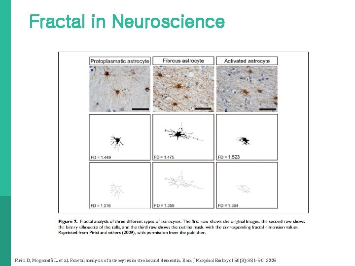 Fractal in Neuroscience Pirici D, Mogoantă L, et al, Fractal analysis of astrocytes in