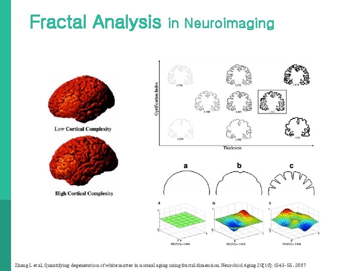 Fractal Analysis in Neuroimaging Zhang L et al, Quantifying degeneration of white matter in