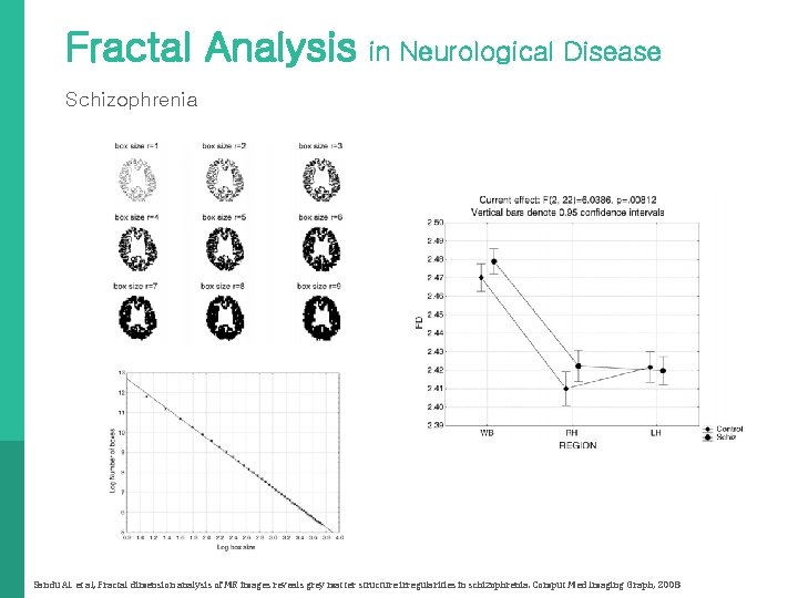 Fractal Analysis in Neurological Disease Schizophrenia Sandu AL et al, Fractal dimension analysis of