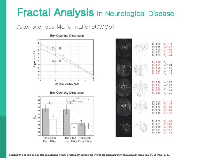 Fractal Analysis in Neurological Disease Arteriovenous Malformations(AVMs) Reishofer G et al, Fractal dimension and