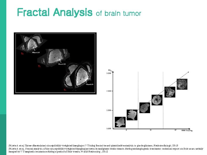 Fractal Analysis of brain tumor Di Ieva A et al, Three-dimensional susceptibility-weighted imaging at