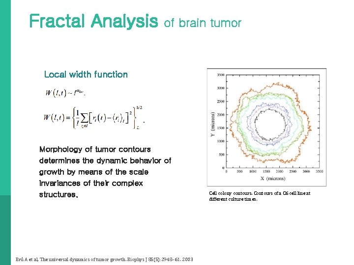 Fractal Analysis of brain tumor Local width function Morphology of tumor contours determines the