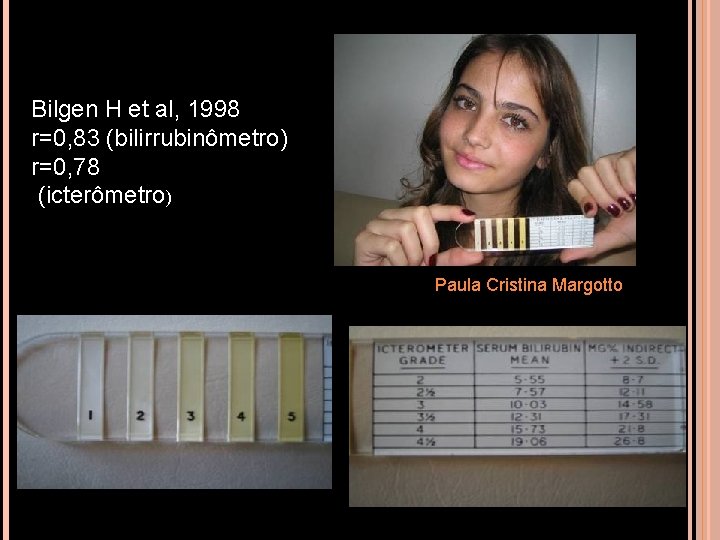 ICTERÔMETRO Bilgen H et al, 1998 r=0, 83 (bilirrubinômetro) r=0, 78 (icterômetro) Paula Cristina