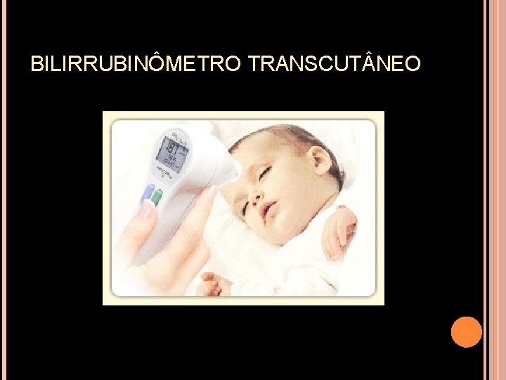 BILIRRUBINÔMETRO TRANSCUT NEO 