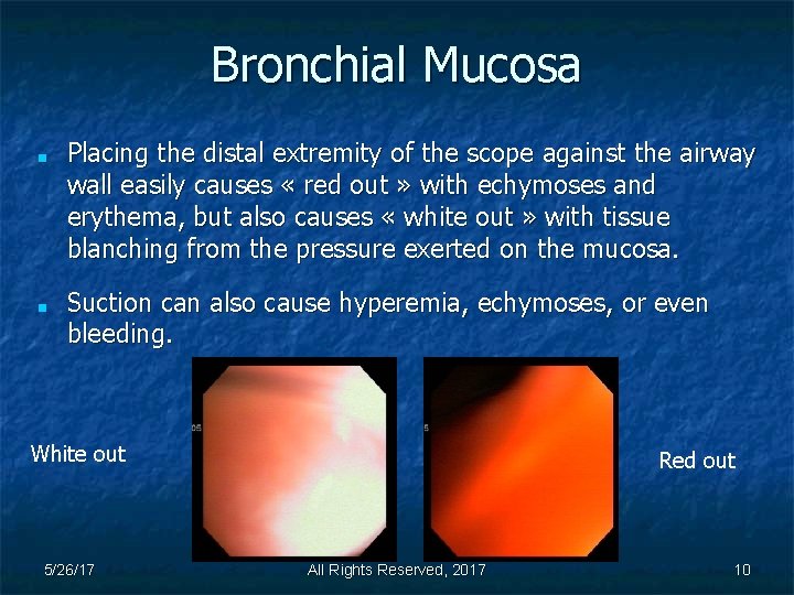 Bronchial Mucosa ■ ■ Placing the distal extremity of the scope against the airway