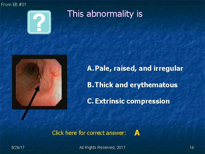From EB #31 This abnormality is A. Pale, raised, and irregular B. Thick and