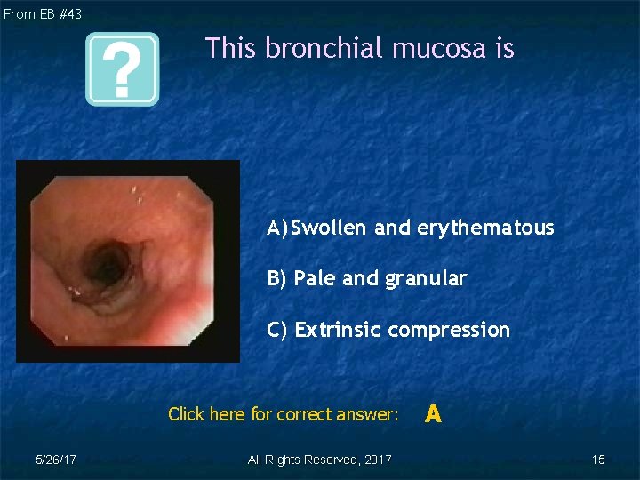 From EB #43 This bronchial mucosa is A) Swollen and erythematous B) Pale and