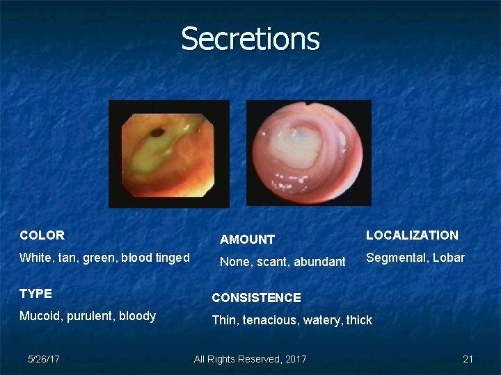Secretions COLOR AMOUNT LOCALIZATION White, tan, green, blood tinged None, scant, abundant Segmental, Lobar