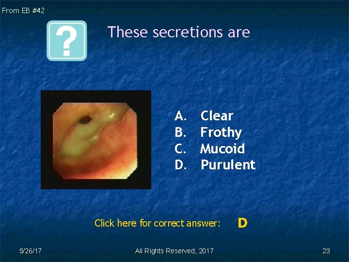 From EB #42 These secretions are A. B. C. D. Clear Frothy Mucoid Purulent