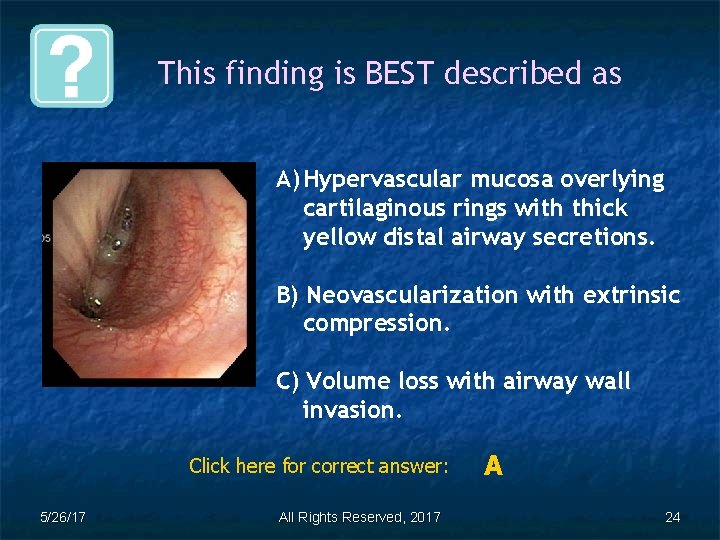This finding is BEST described as A) Hypervascular mucosa overlying cartilaginous rings with thick