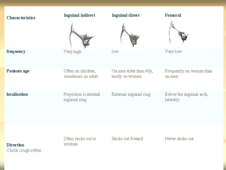 Characteristics Inguinal indirect Inguinal direct Femoral Дифференциальная диагностика грыж в паховой области frequency Very