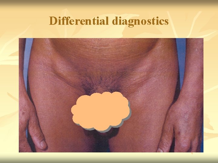 Differential diagnostics 