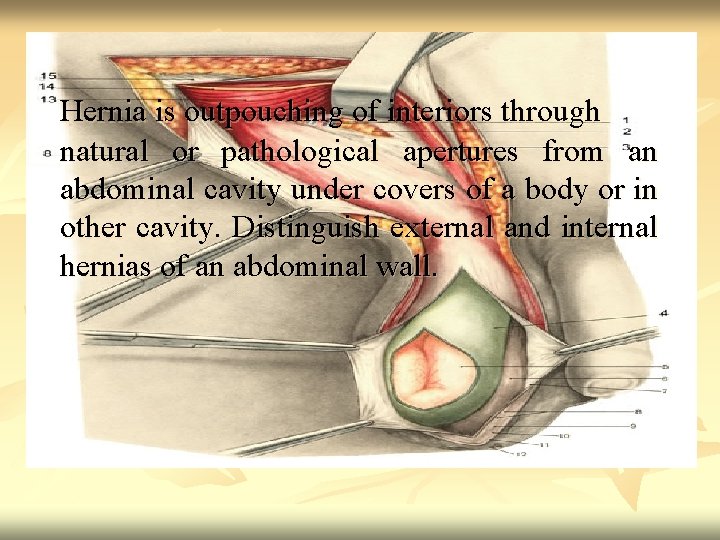 Hernia is outpouching of interiors through natural or pathological apertures from an abdominal cavity