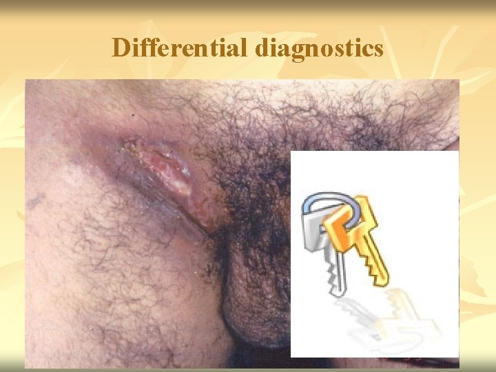 Differential diagnostics 