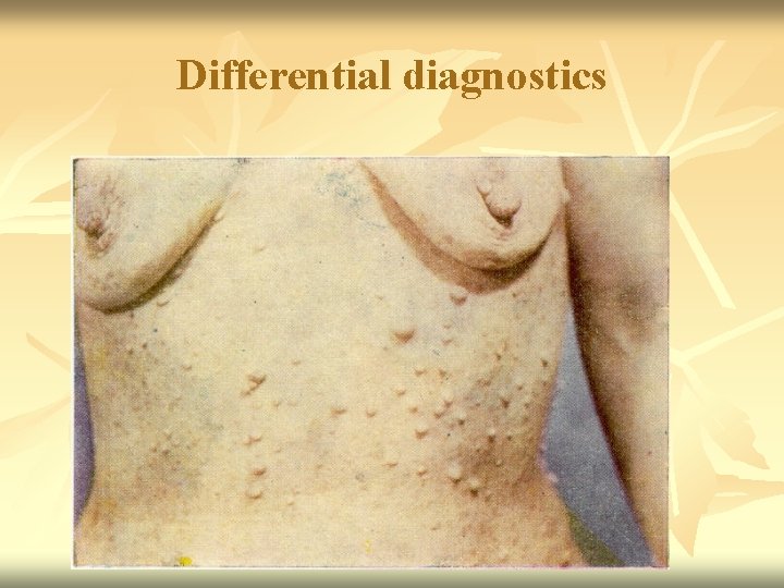 Differential diagnostics 