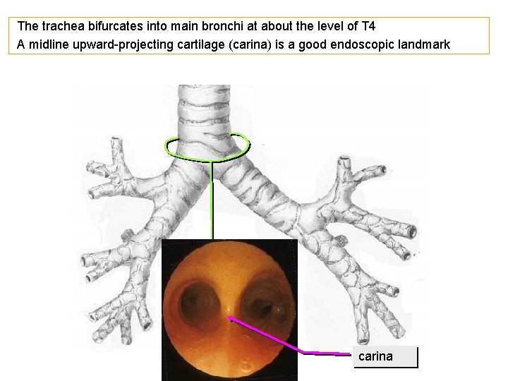 The trachea bifurcates into main bronchi at about the level of T 4 A