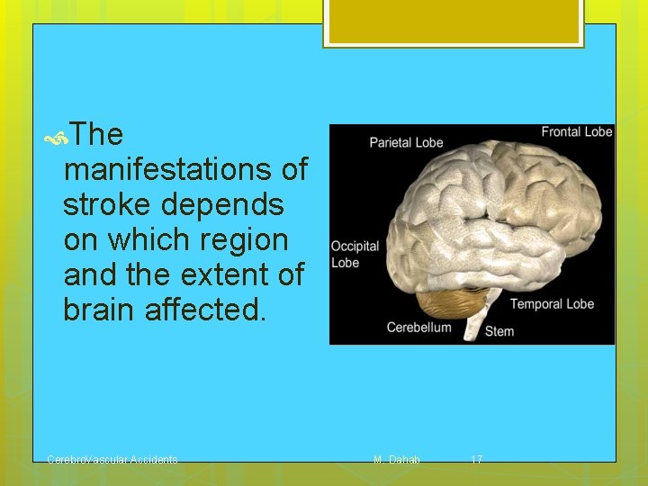  The manifestations of stroke depends on which region and the extent of brain