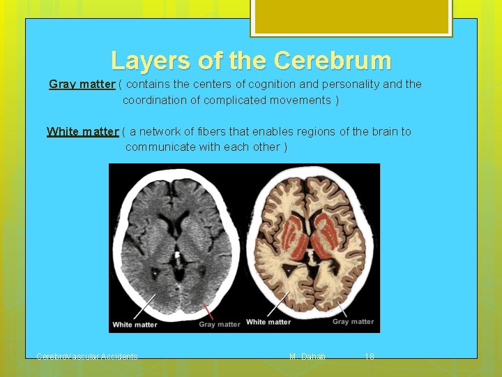 Layers of the Cerebrum Gray matter ( contains the centers of cognition and personality