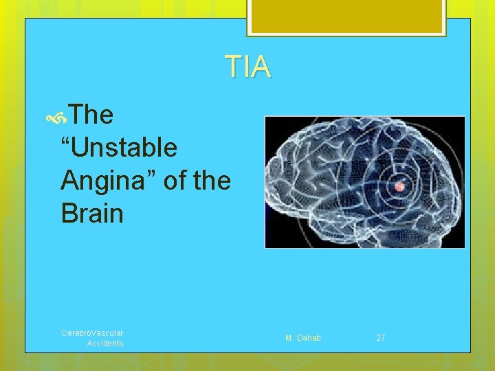 TIA The “Unstable Angina” of the Brain Cerebro. Vascular Accidents M. Dahab 27 