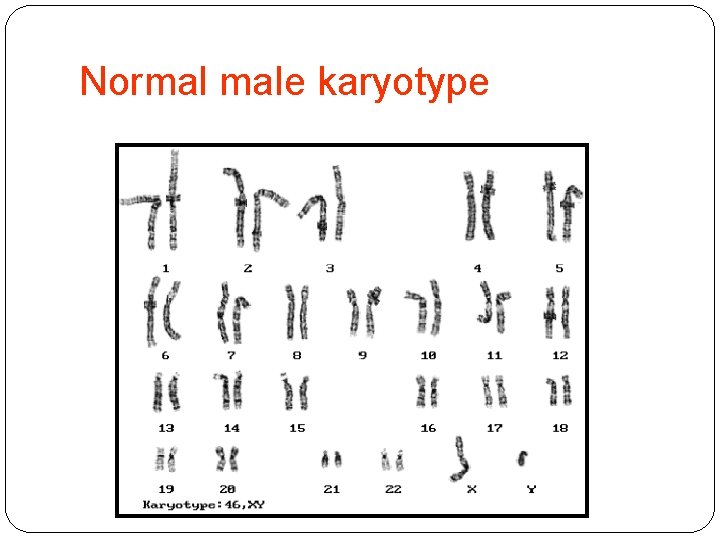 Normal male karyotype 