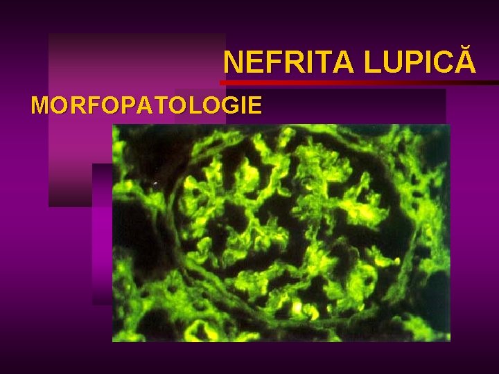 NEFRITA LUPICĂ LUPIC MORFOPATOLOGIE 