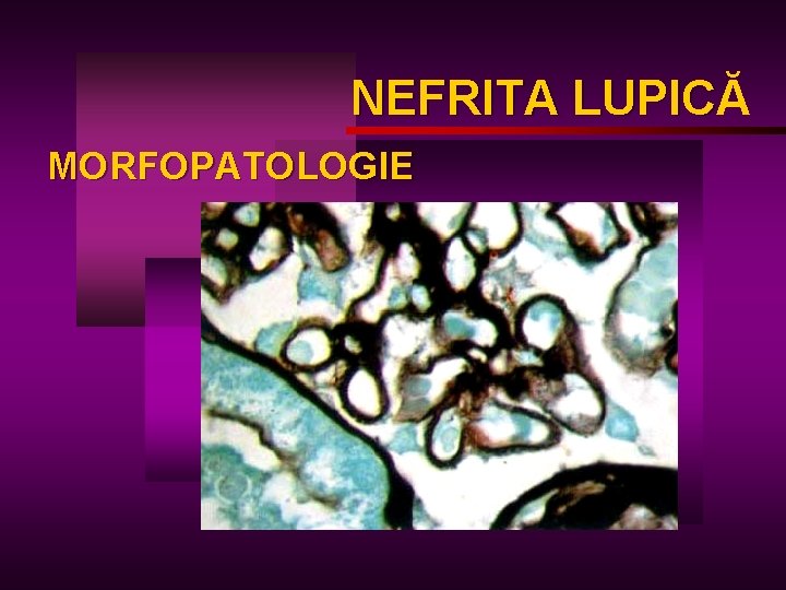 NEFRITA LUPICĂ LUPIC MORFOPATOLOGIE 