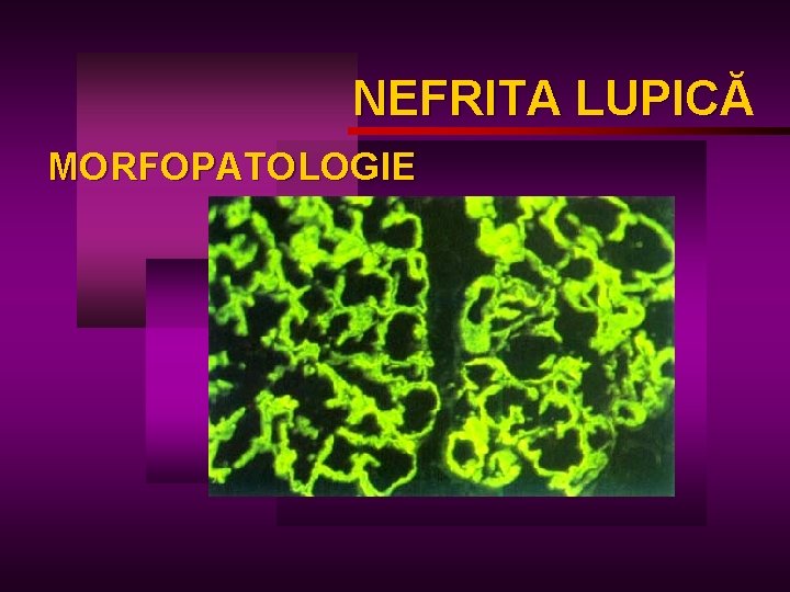 NEFRITA LUPICĂ LUPIC MORFOPATOLOGIE 