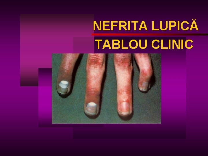 NEFRITA LUPICĂ LUPIC TABLOU CLINIC 