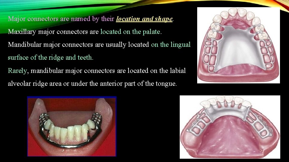 Major connectors are named by their location and shape. Maxillary major connectors are located