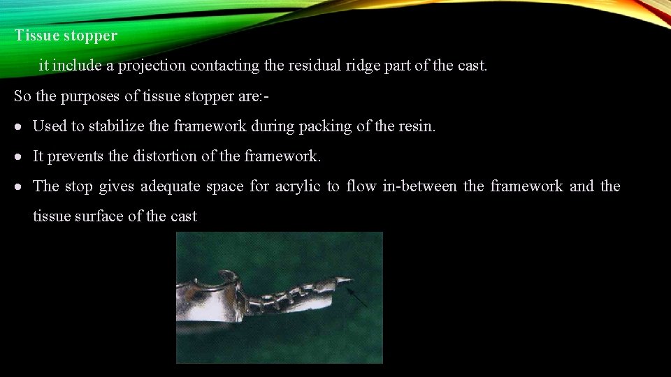 Tissue stopper it include a projection contacting the residual ridge part of the cast.