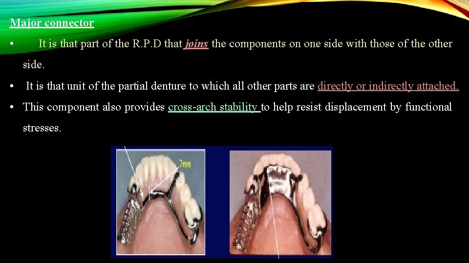 Major connector • It is that part of the R. P. D that joins