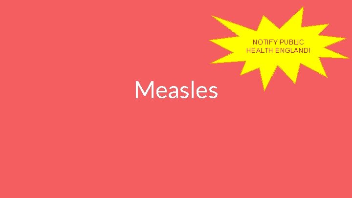 NOTIFY PUBLIC HEALTH ENGLAND! Measles 
