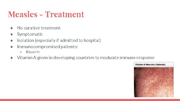 Measles - Treatment ● ● No curative treatment Symptomatic Isolation (especially if admitted to