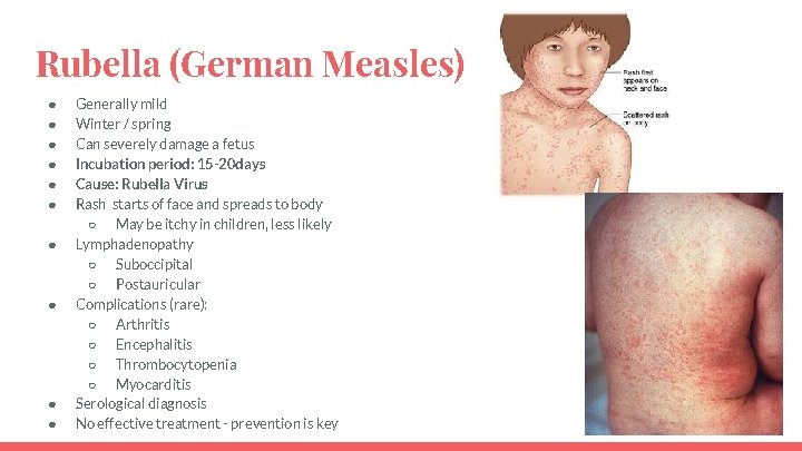 Rubella (German Measles) ● ● ● ● ● Generally mild Winter / spring Can
