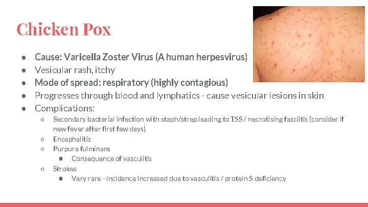 Chicken Pox ● ● ● Cause: Varicella Zoster Virus (A human herpesvirus) Vesicular rash,