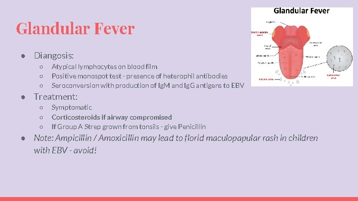 Glandular Fever ● Diangosis: ○ ○ ○ Atypical lymphocytes on blood film Positive monospot