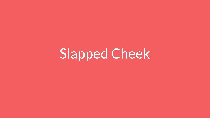 Slapped Cheek 