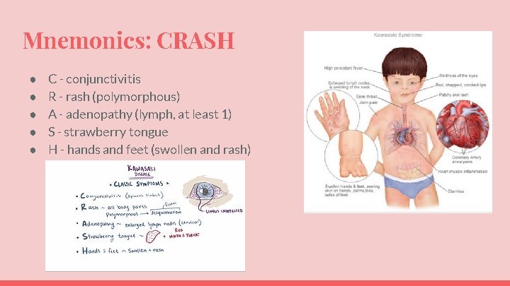 Mnemonics: CRASH ● ● ● C - conjunctivitis R - rash (polymorphous) A -