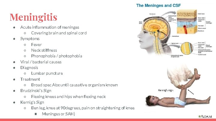 Meningitis ● ● ● ● Acute inflammation of meninges ○ Covering brain and spinal