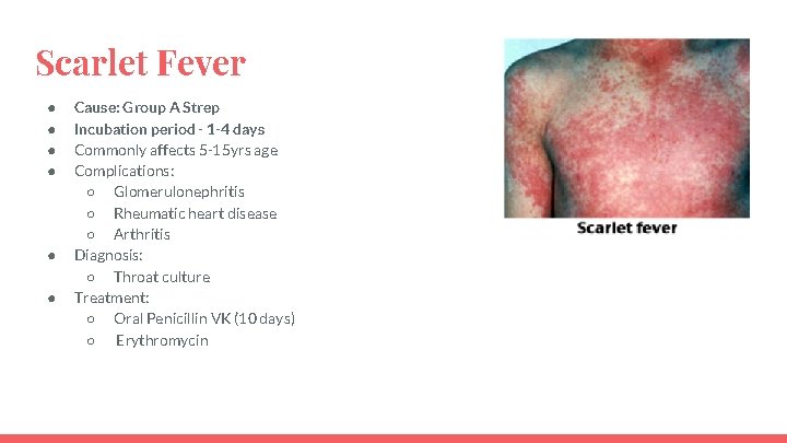 Scarlet Fever ● ● ● Cause: Group A Strep Incubation period - 1 -4