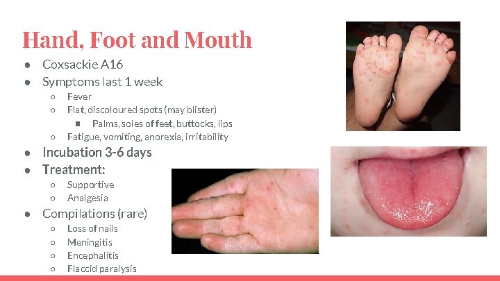 Hand, Foot and Mouth ● Coxsackie A 16 ● Symptoms last 1 week ○