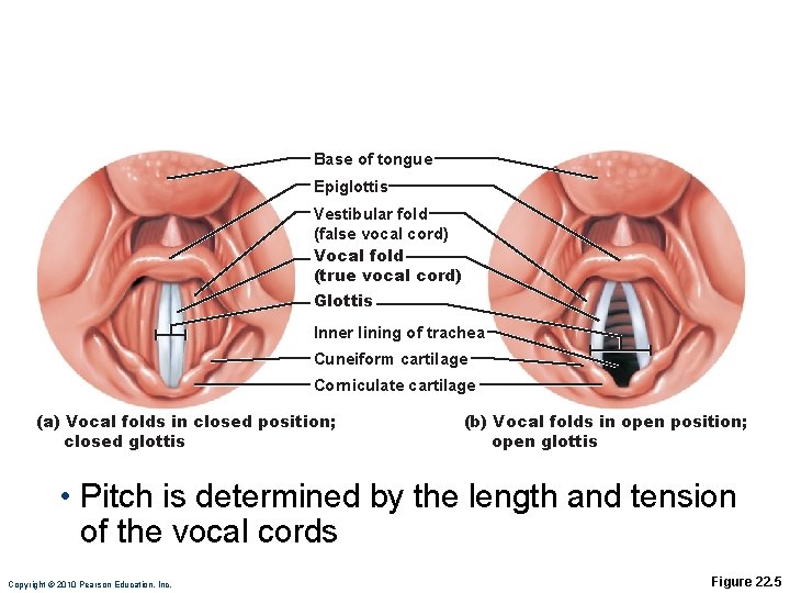 Base of tongue Epiglottis Vestibular fold (false vocal cord) Vocal fold (true vocal cord) Base of tongue Epiglottis Vestibular fold (false vocal cord) Vocal fold (true vocal cord)