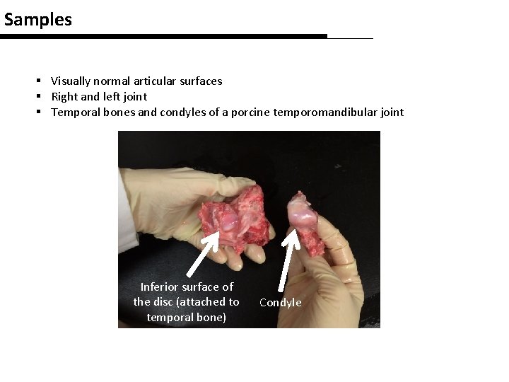 Samples § Visually normal articular surfaces § Right and left joint § Temporal bones